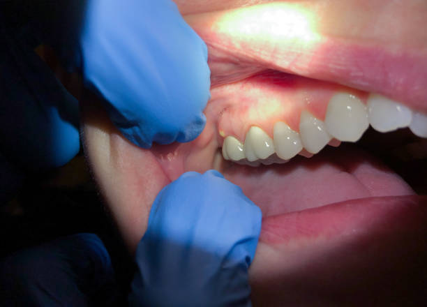 Best Orthodontic Emergency Dentist in Saranac, MI