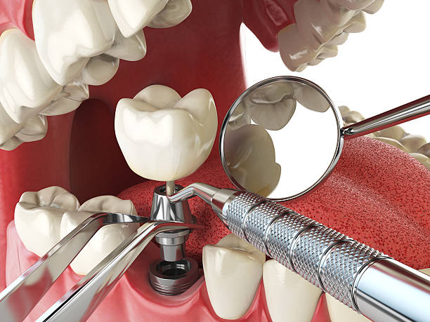 Best Emergency Cosmetic Dentistry in Saranac, MI