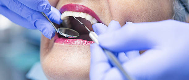Best Broken or Cracked Tooth Emergency Dentist in Saranac, MI